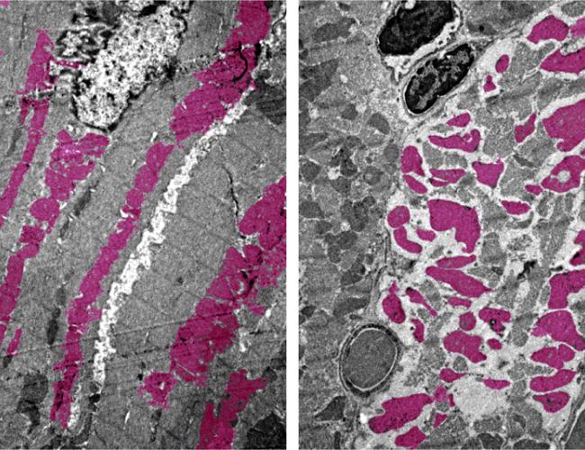 Heart muscle cells in an uninfected mouse (left) and a mouse infected with SARS-CoV-2 (right) with mitochondria seen in pink. The disorganization of the cells and mitochondria in the image at right is associated with irregular heartbeat and death.