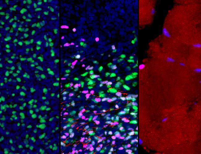These microscopic images show gene expression in muscle stem and progenitor cells as they mature from early development to adulthood (left to right). As part of this process, the cells switch from actively expressing one key gene (green) to another (violet); this is accompanied by the growth of muscle fibers (red).