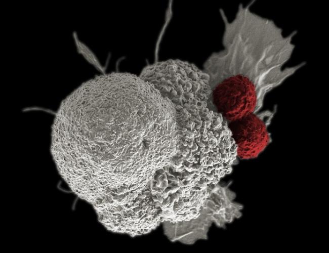 A cancer cell (white) being attacked by two T cells (red). 
