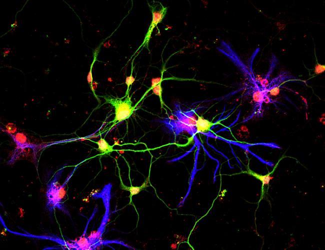 Neurons (in green) producing growth differentiation factor 10 (red), a molecule discovered by UCLA scientists that previously had no known role in the adult brain.