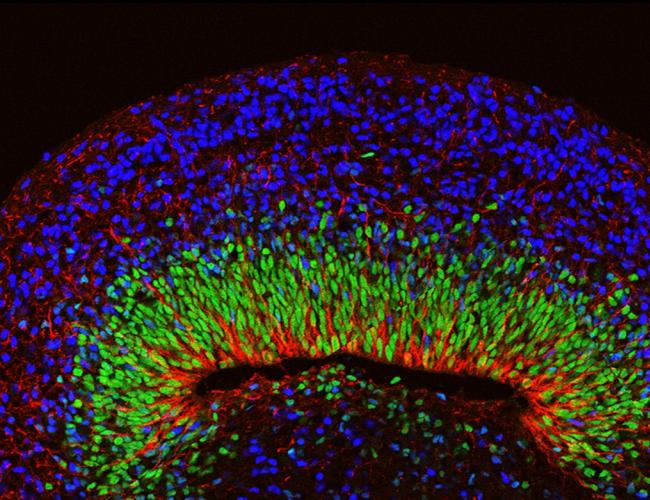 A microscope image of a mini brain organoid showing layered neural tissue and different types of neural cells.