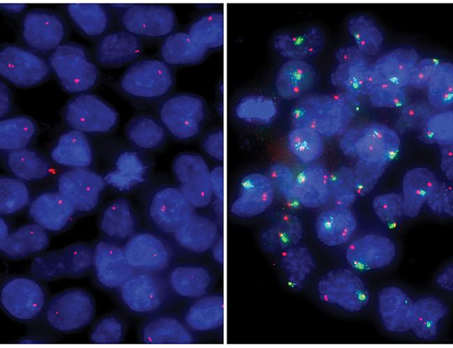 Left: Primed human embryonic stem cells have one active X chromosome (one red dot in each blue nucleus). Right: Naive human embryonic stem cells have two active X chromosomes (two red dots in each blue nucleus).