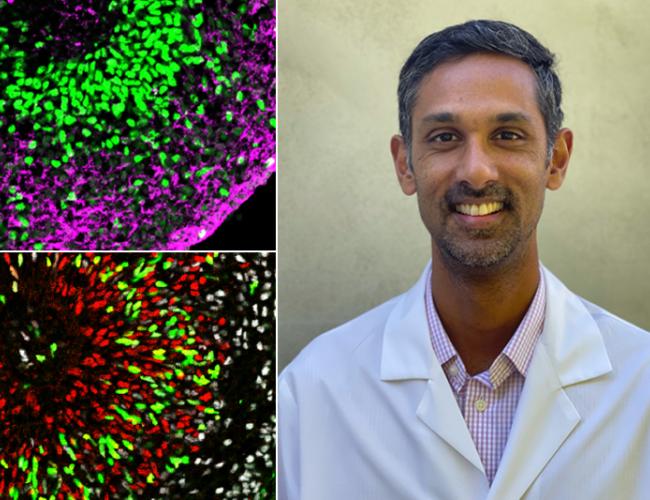 Microscope images of stem cell-derived organoids replicating different parts of the human brain. Dr. Ranmal Samarasinghe