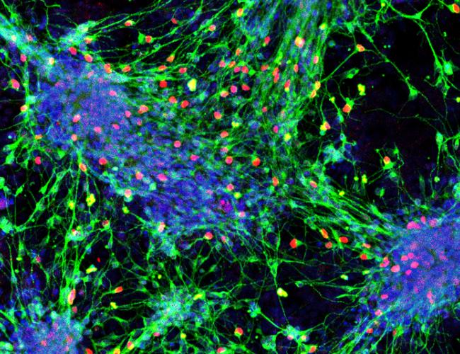 Sensory interneurons (with nuclei in red) derived from mouse stem cells.