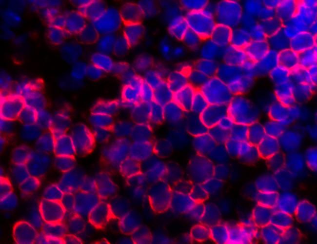 T cells (red) produced using artificial thymic organoids developed at UCLA.