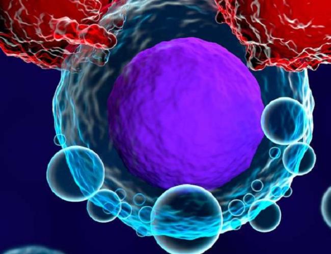 Cancer cell image.