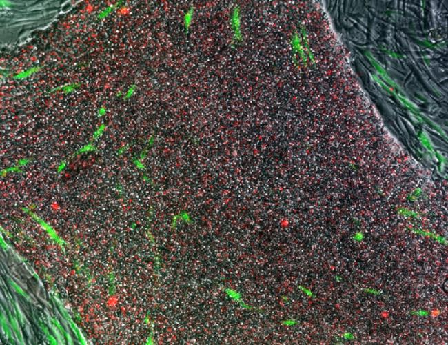 Cell colony with induced pluripotent stem cells stained in red using the TRA method