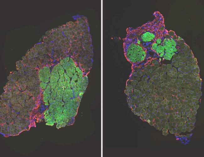 Microscopic images of regenerated mouse muscles transplanted with muscle stem cells (green) from old mice that have high levels of glutathione (left) and low levels of glutathione (right). Muscle stem cells with high glutathione levels are much more effective at contributing to new muscle tissue.