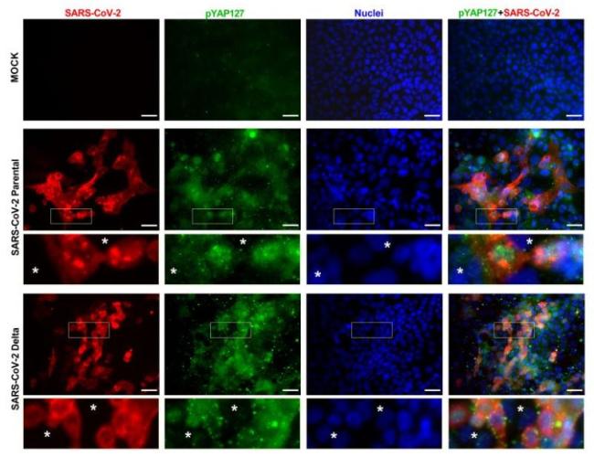 This chart shows levels of SARS-CoV-2 and deactivated YAP (pYAP127) in healthy cultured cells (mock) and cultured cells infected with the original strain of COVID-19 (SARS-CoV-2 Parental) and the Delta strain (SARS-CoV-2 Delta). Asterisks in the insets indicate uninfected cells.