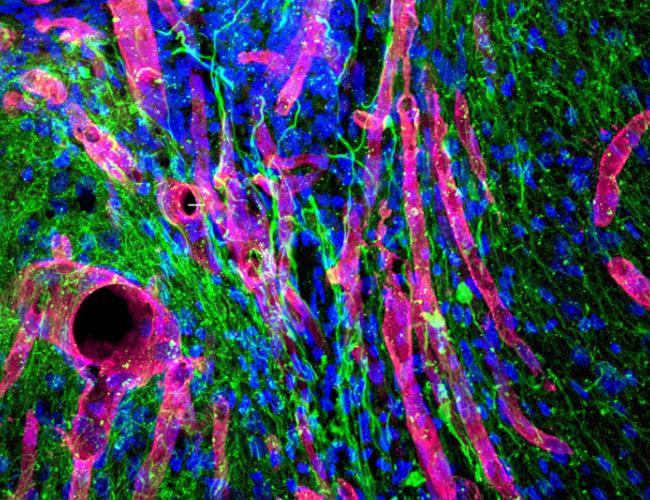A photomicrograph showing new tissue growing in the stroke cavity in a mouse. Red tubes are blood vessels; green filaments are nerve fibers.