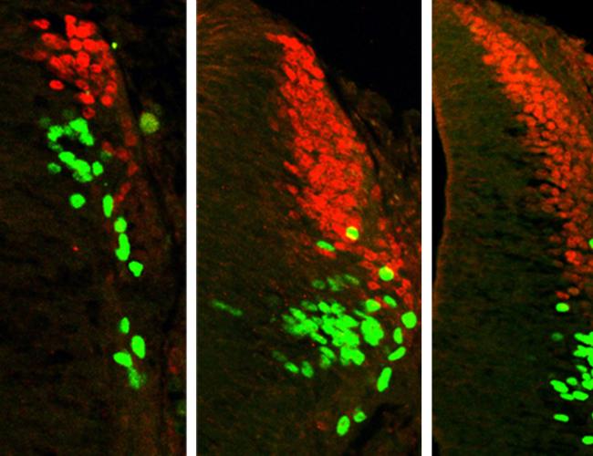 Increasing the concentration of a certain type of BMP increases the production of the same categories of sensory interneurons (red and green). Left: no BMP added; center: 1x BMP added; right: 10x BMP added.