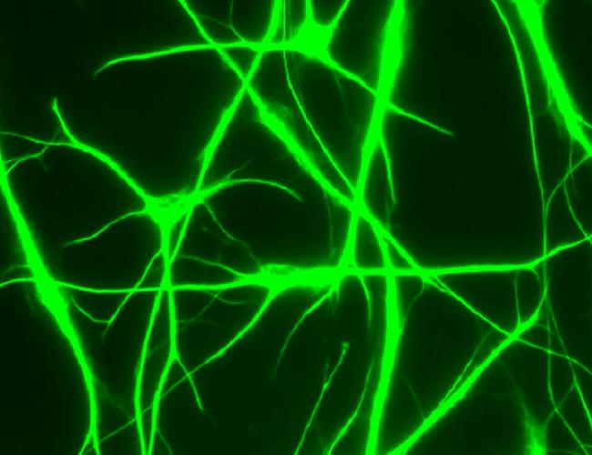 Microscope image of human astrocytes, star-shaped brain cells that play a substantial role in neurological disorders. 