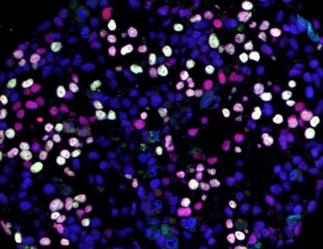 Differentiating human pluripotent stem cells (blue) turning into human germ cells (pink and white).
