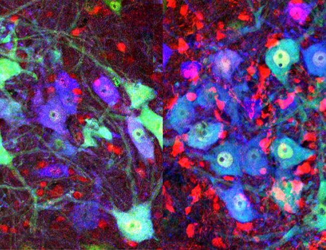 Image shows post-natal mouse spinal cord with the protein cofilin in red at left. At right, the cofilin (in red) has been inactivated by the gene Limk1. Neurons are shown in green and motor neurons in blue.