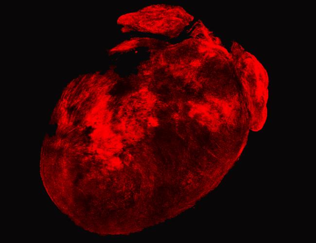 A mouse heart with cardiomyocytes dissolved, leaving a 3-D scaffold of cardiac fibroblasts. Concentrated areas of red represent post-heart attack aggregation of cardiac fibroblasts.