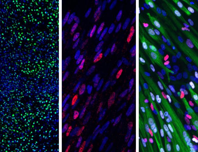 The new protocol turned 90 percent of human pluripotent stem cells into somite cells in just four days; those somite cells then generated (left to right) cartilage, bone and muscle cells.