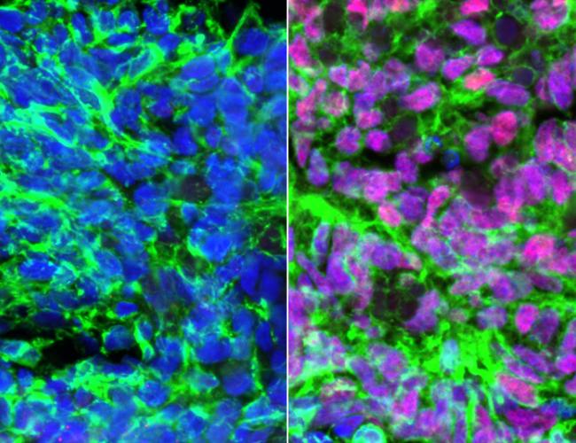 Human embryonic stem cell-derived neurons (green) showing nuclei in blue. Left: with retinoic acid added. Right: with retinoic acid and BMP4 added, creating proprioceptive sensory interneurons (pink).