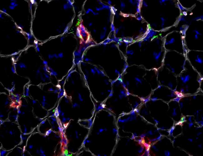 Nanoparticles (green) injected intravenously into mice are capable of entering muscle (outlined in grey) from blood vessels (red).