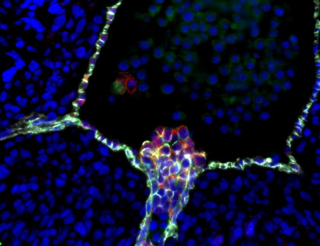 Human blood stem cells emerging from specialized endothelial cells in the wall of an embryonic aorta. UCLA scientists’ confirmation of this process clarifies a longstanding controversy about the stem cells’ cellular origin. 