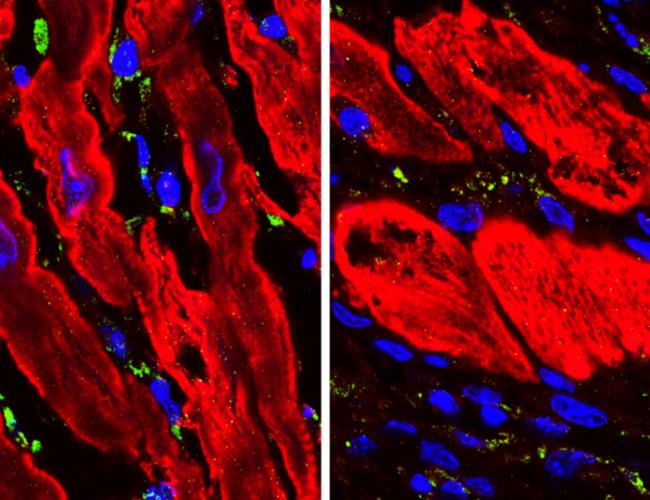 Microscopic images showing heart tissue in mice (with cardiac muscle cells in red) after a heart attack. Untreated tissue (left) shows more DNA damage (green) than tissue that has been treated with an experimental drug (right).