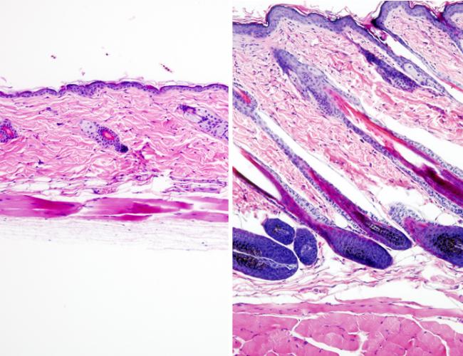 Untreated mouse skin showing no hair growth (left) compared to mouse skin treated with the drug UK5099 (right) showing hair growth. 