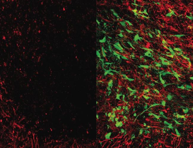 Microscope images showing brain tissue that has been damaged by white matter stroke (left) and then repaired by the new glial cell therapy (right). Myelin (seen in red), is a substance that protects the connections between neurons and is lost due to white matter stroke. As seen at right, the glial cell therapy (green) restores lost myelin and improves connections in the brain. 