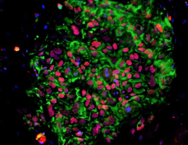 A colony of human induced pluripotent stem cells