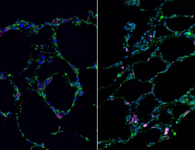 3-D bioengineered lung-like tissue (left) resembles adult human lung (right).