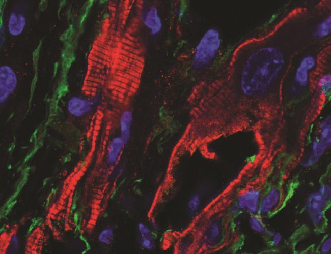 Immunofluorescent staining demonstrating fibroblasts expressing the Channelrhodopsin protein in heart scar tissue. The ChR2-expressing fibroblast (green) is in close proximity to cardiomyocytes (red) within scar.