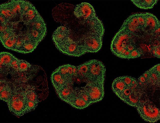 Slices of mini–brain organoids with neural stem cells (red) and cortical neurons (green)