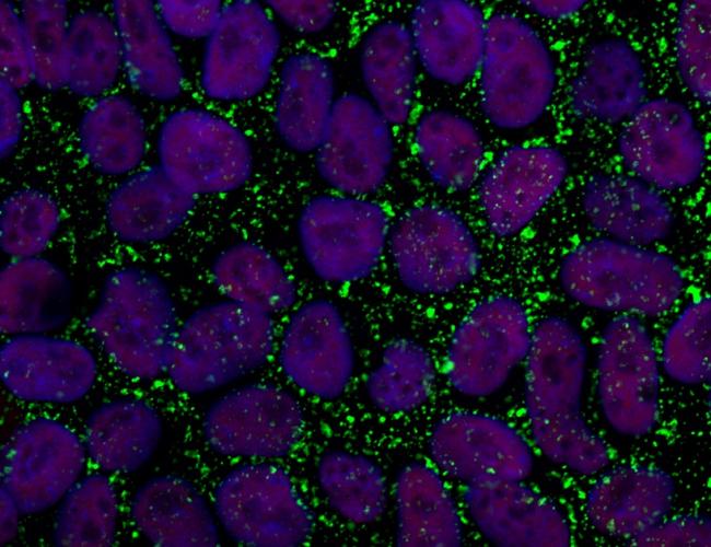 Primed human embryonic stem cells (purple) surrounded by a stem cell surface marker (green), which would be missing in naïve embryonic stem cells.
