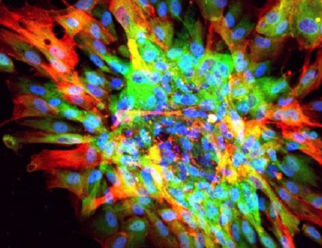 Microscopic image of scarring in a dish, showing evidence of fibrosis (red, green) and nuclei of all cells (blue).