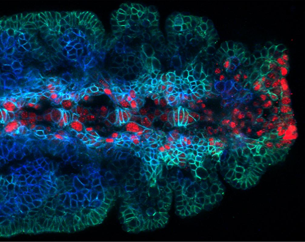 2019 Second Place Microscopy Contest