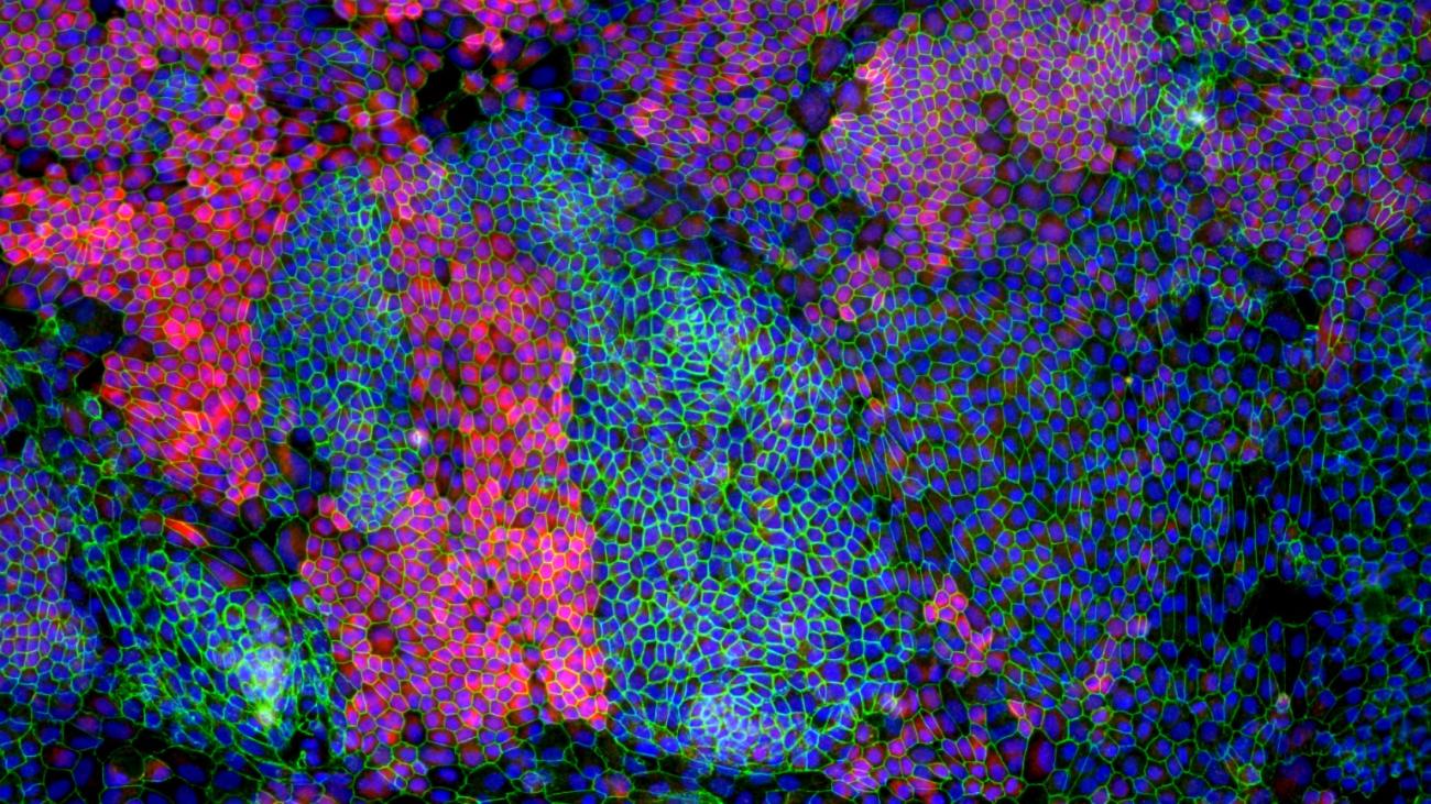 Microscopy Image of Retinal Epithelium Cells