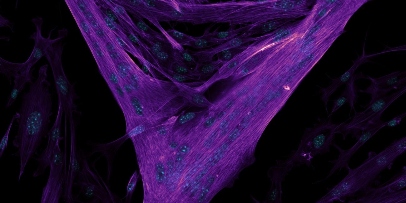 Microscopic image of muscle cells fusing to form myotubes with the cytoskeletal structures (purple) and nuclei (teal) visible
