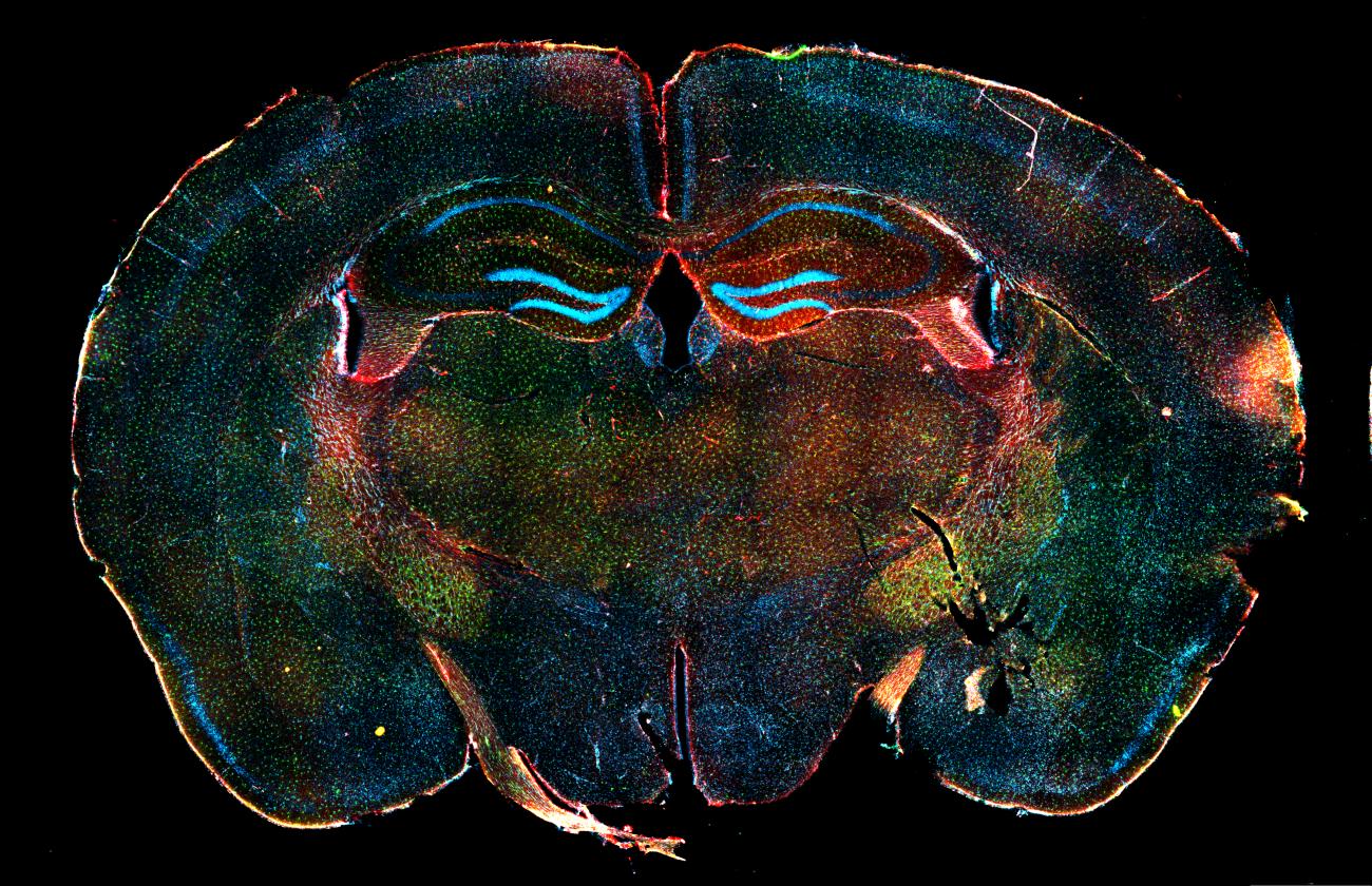 a microscopic image of a mouse brain displaying the main defensive players of our central nervous system