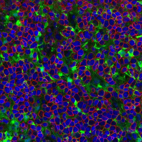 A section of an artificial thymic organoid showing T cells (outlined in red) created from human embryonic stem cells.