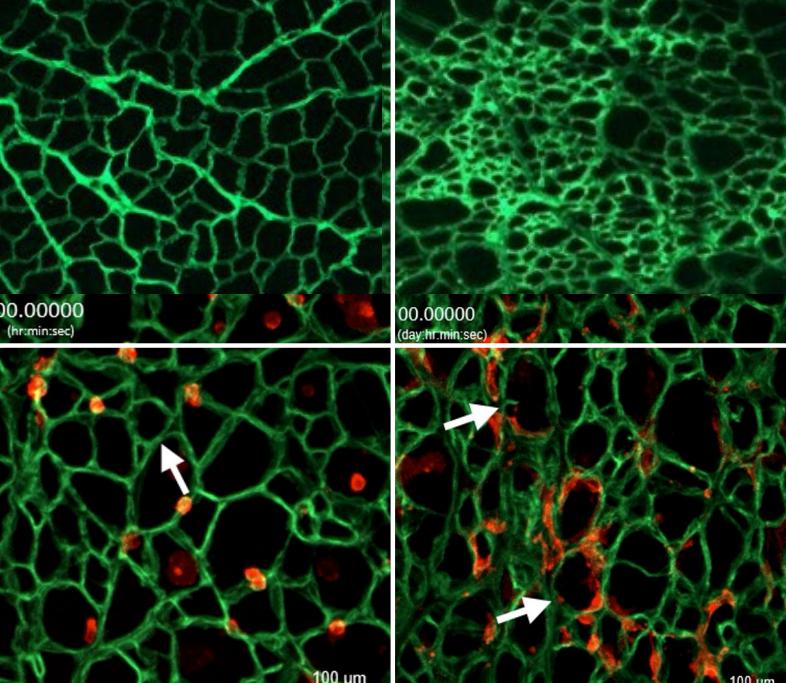 Duchenne microscope images.