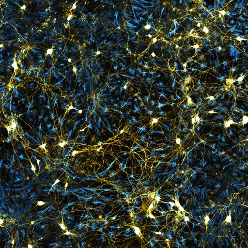 Mouse embryonic stem cell-derived motor neurons (yellow) and glia (blue). Imaged on a Zeiss LSM 700 | Credit: BSCRC-MCDB Microscopy Core, UCLA