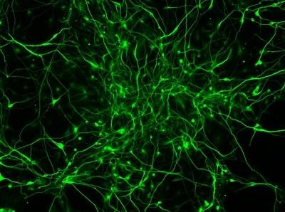 Microscopic image of neurons grown from human induced pluripotent stem cells.