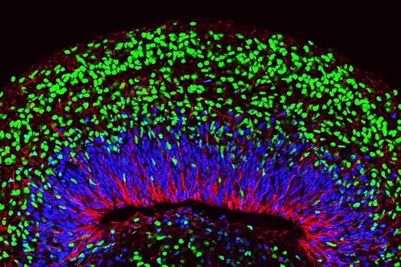 A week 8 mini–brain organoid showing the radial processes (red) of neural stem cells (blue) and formation of neurons (green) on the outer margins of the organoids.