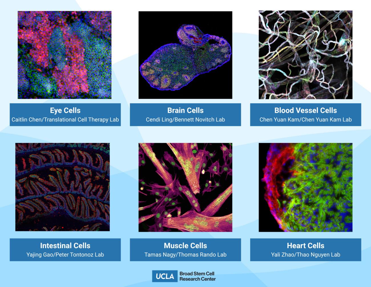 An answer key to a UCLA "guess the cells" game featuring microscope imagery. 