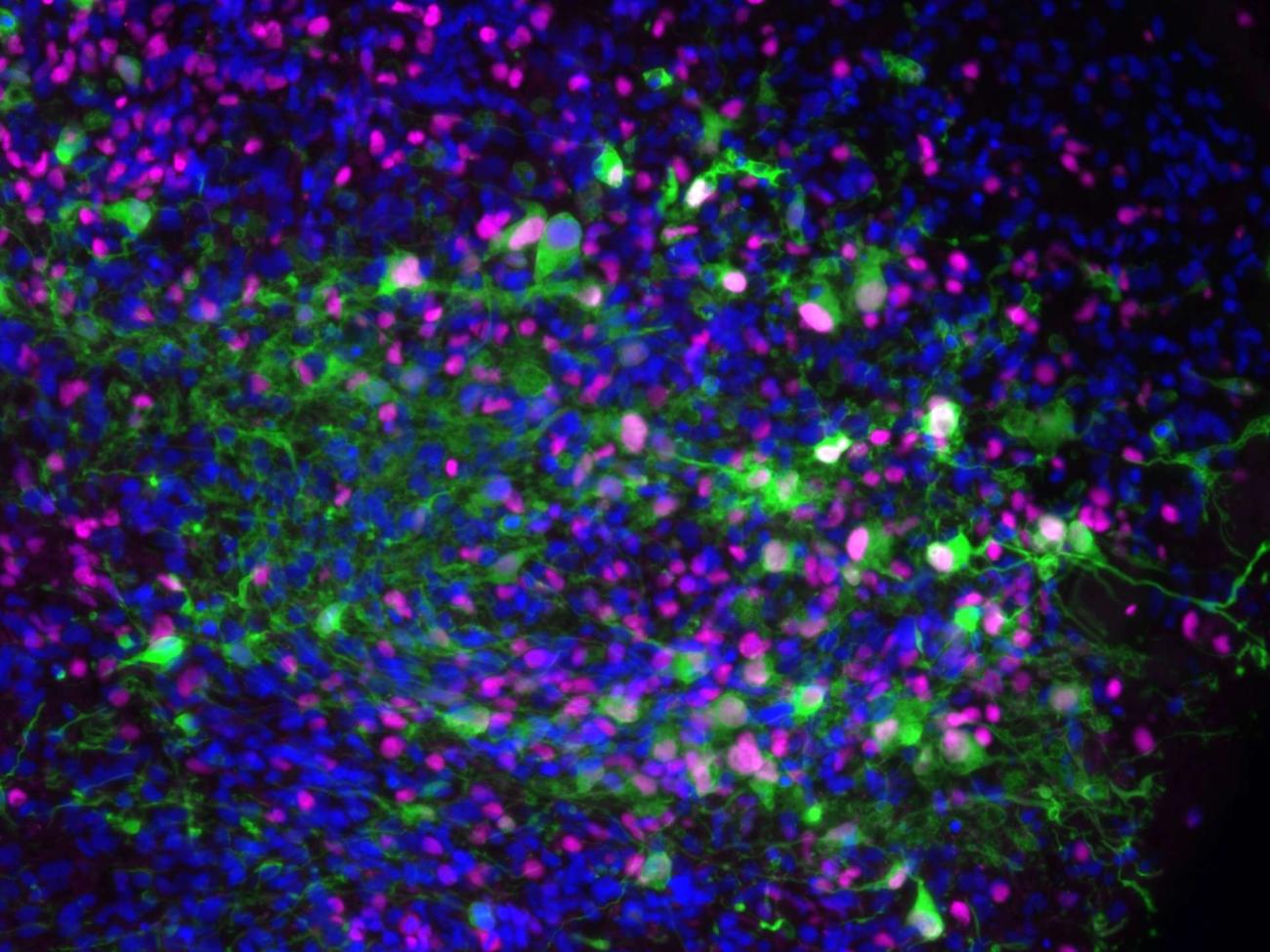 Fluorescence microscopy image showing tumor cells (green) with cancer proliferation markers (magenta) and nuclei (blue) in a HOTT system.