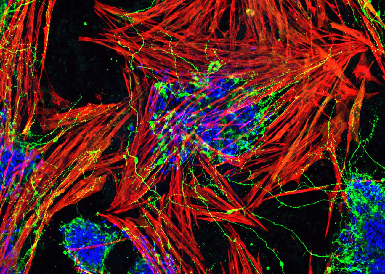 This image depicts the simultaneous differentiation of muscles and motor neurons from the mouse embryonic stem cell-derived NMPs. The cultures were fixed and stained with neurons and muscle-specific antibodies. Motor neurons are labeled with a neuronal marker-Tuj1 (in green).