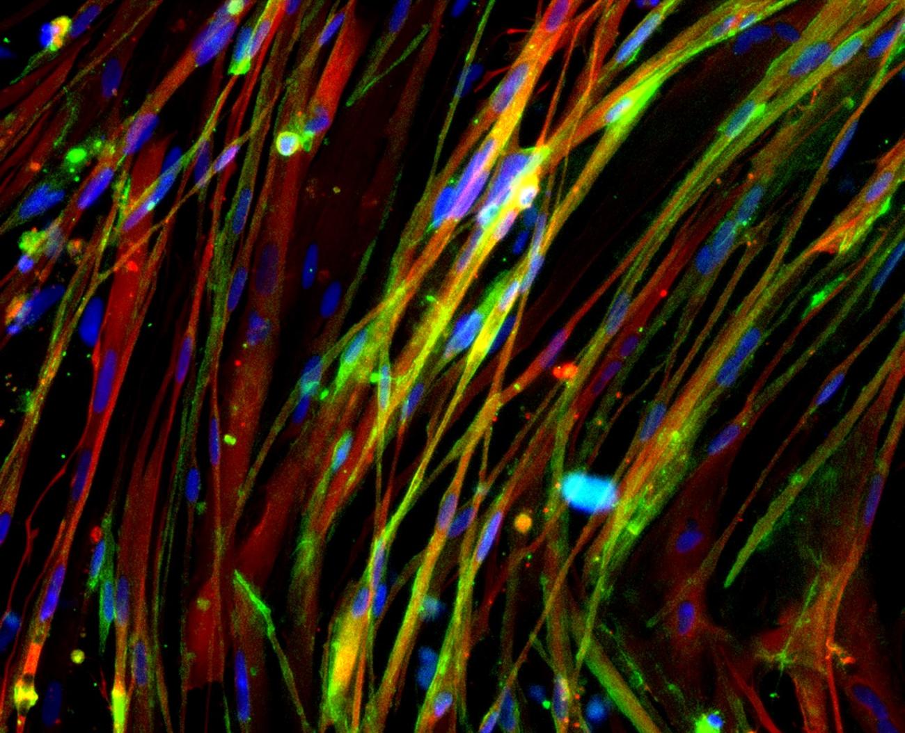Vibrant cell microscopy image of bone muscle 