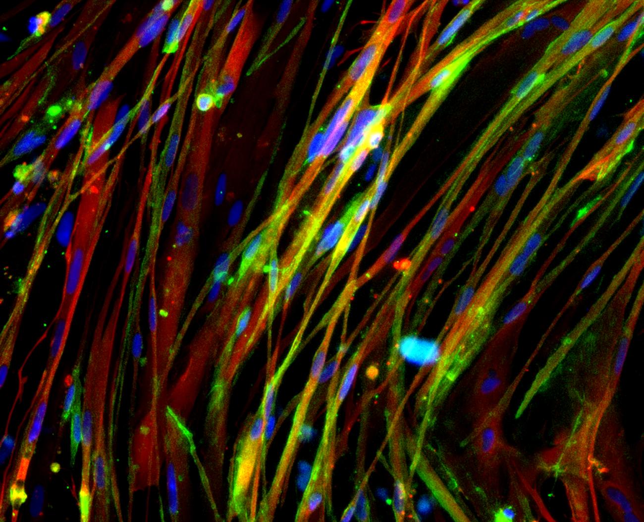 A microscopy image demonstrating restoration of beta dystroglycan in muscle myotubes derived from CRISPR/Cas9 corrected DMD human induced pluripotent stem cells.