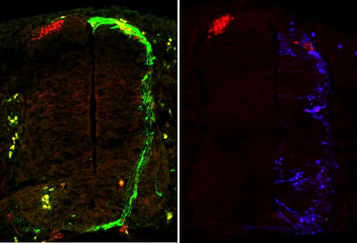 Side by side images of control and experimental spinal cords.