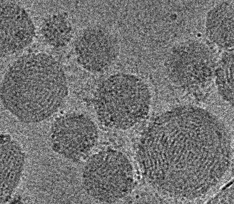 Cryo-TEM image showing spherical lipid nanoparticles loaded with CRISPR/Cas9 gene-editing components, including Cas9 mRNA, guide RNA, and a double-stranded CFTR DNA template
