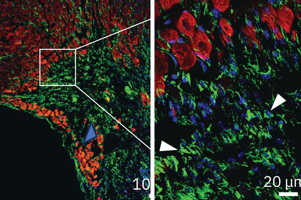 Cardiac muscle shown in red and ENPP1 in green demonstrates expression of ENPP1 in the region of scar formation following a heart attack. 