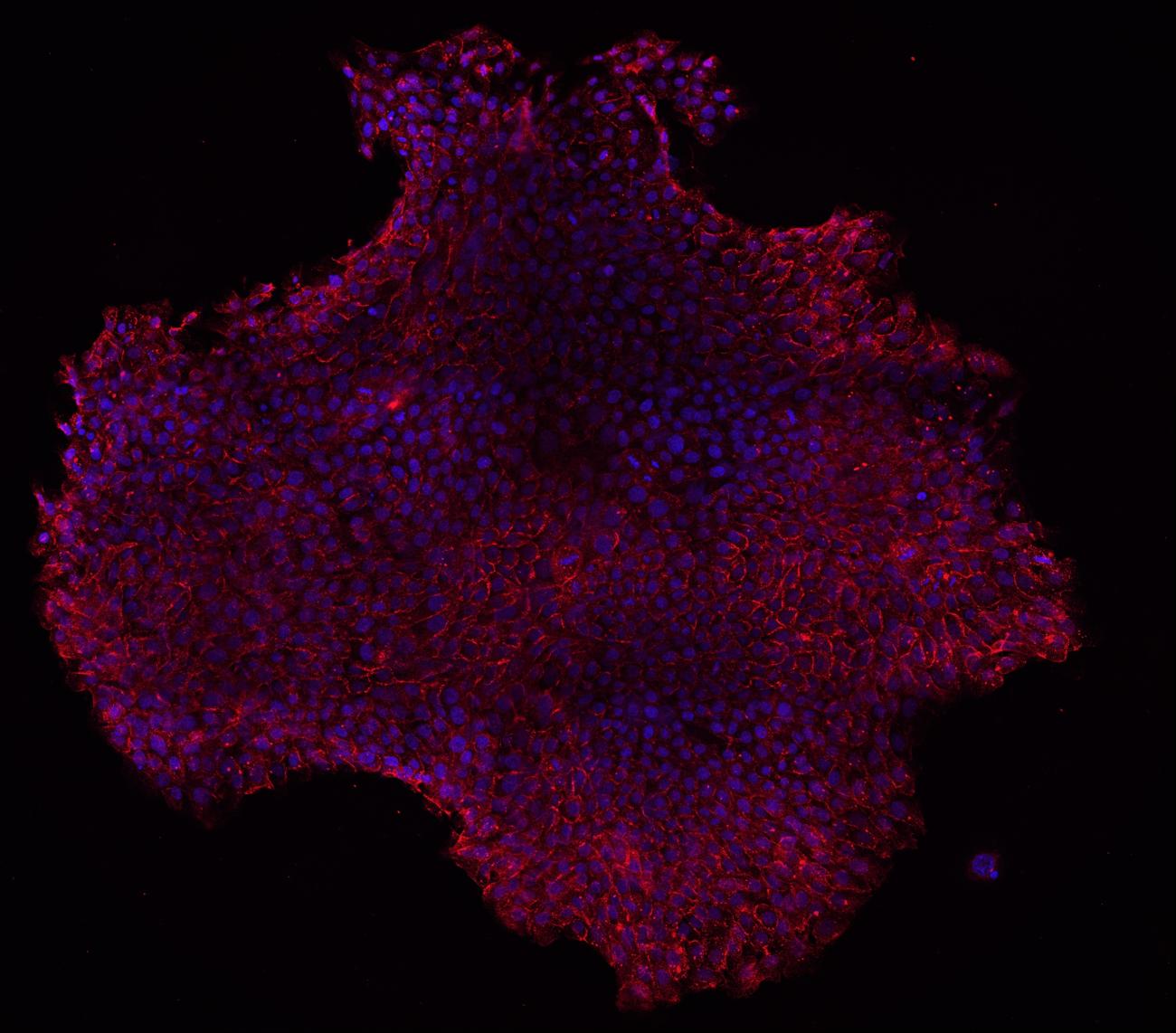 Microscopy image of limbal stem cells generated by UCLA scientists.
